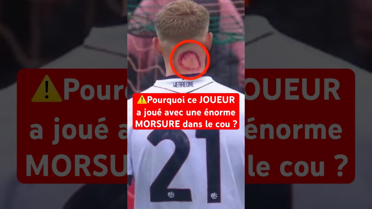 C’est QUOI ce TRUC ? 😱 #football #seriea #mystere #maillot #italie #psg #messi #cr7